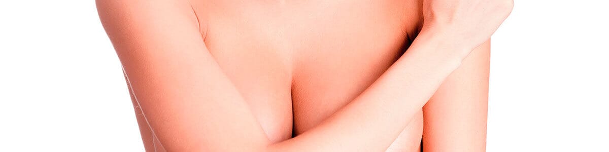 Mamoplastia de aumento