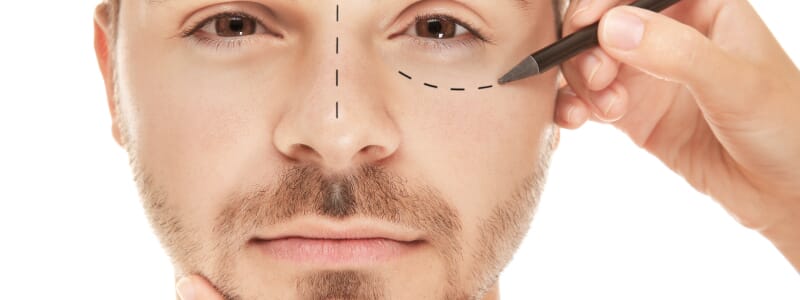 Cirurgias plásticas nos homens: quais são as mais realizadas?